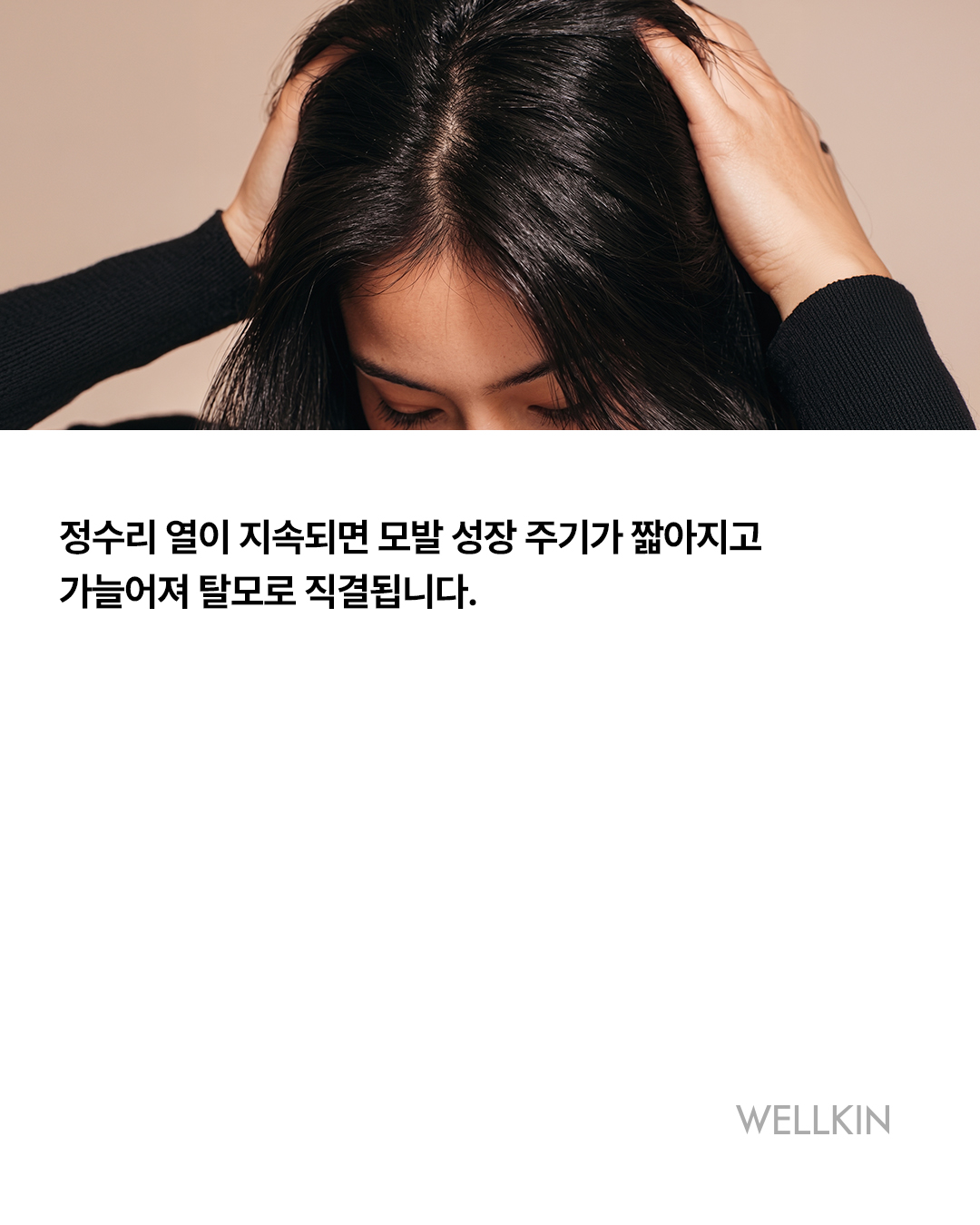웰킨두피탈모센터 일산화정점 대표 이미지