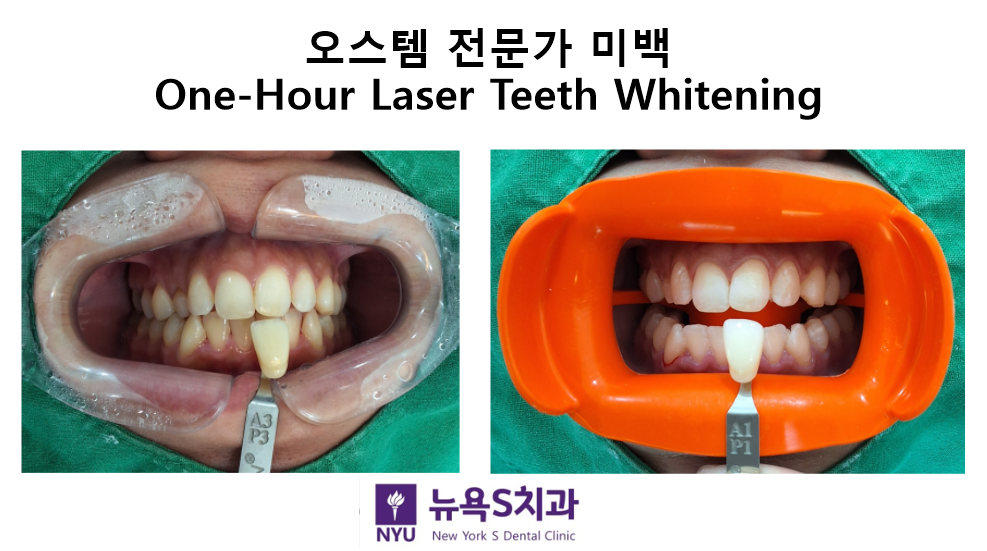 뉴욕S치과의원 광화문 대표 이미지