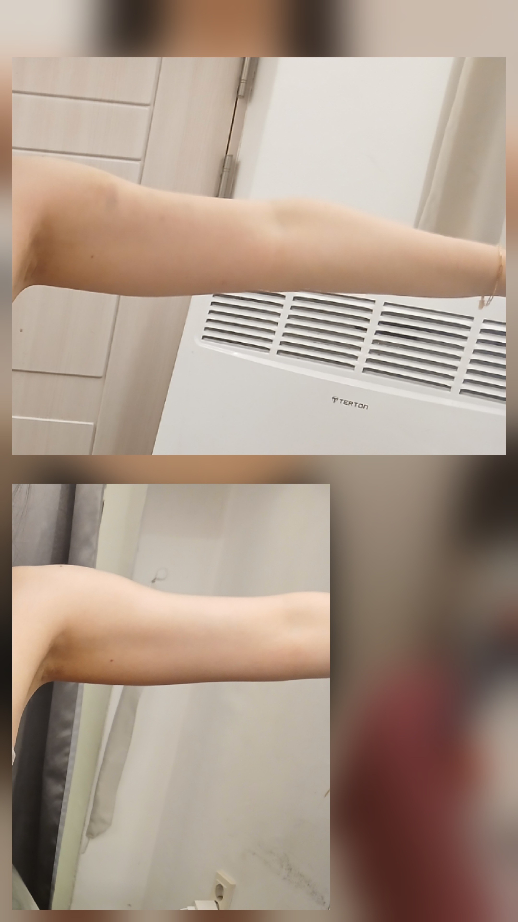 아르케뷰센 photo 2