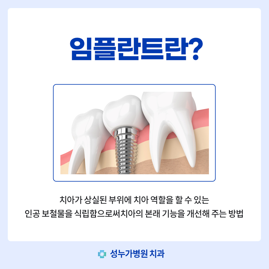 성누가병원 임플란트센터 대표 이미지