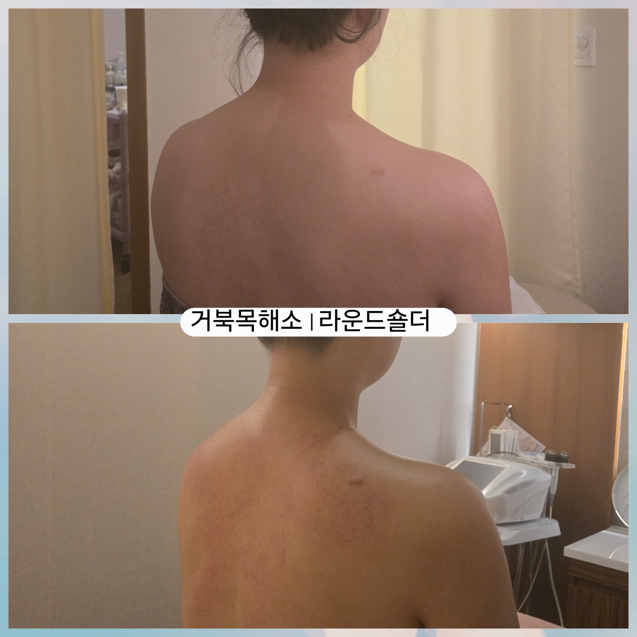 리본테라피 photo 9