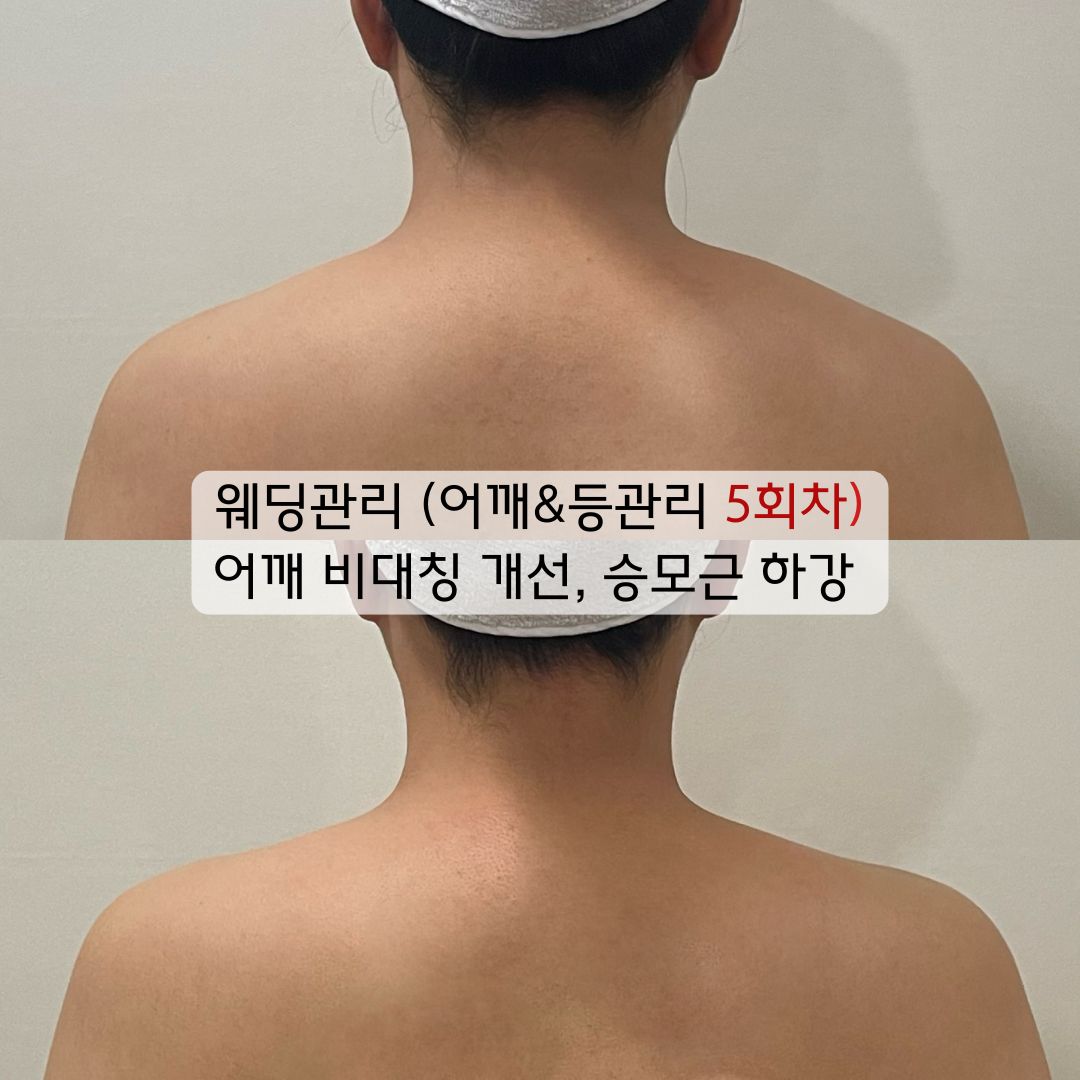더셀라 photo 10