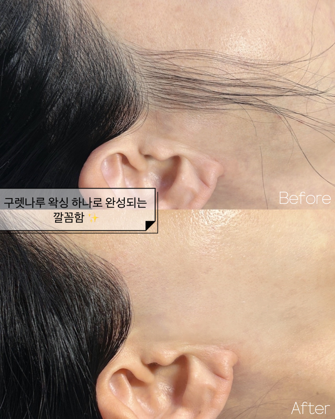 하이뷰티 대표 이미지