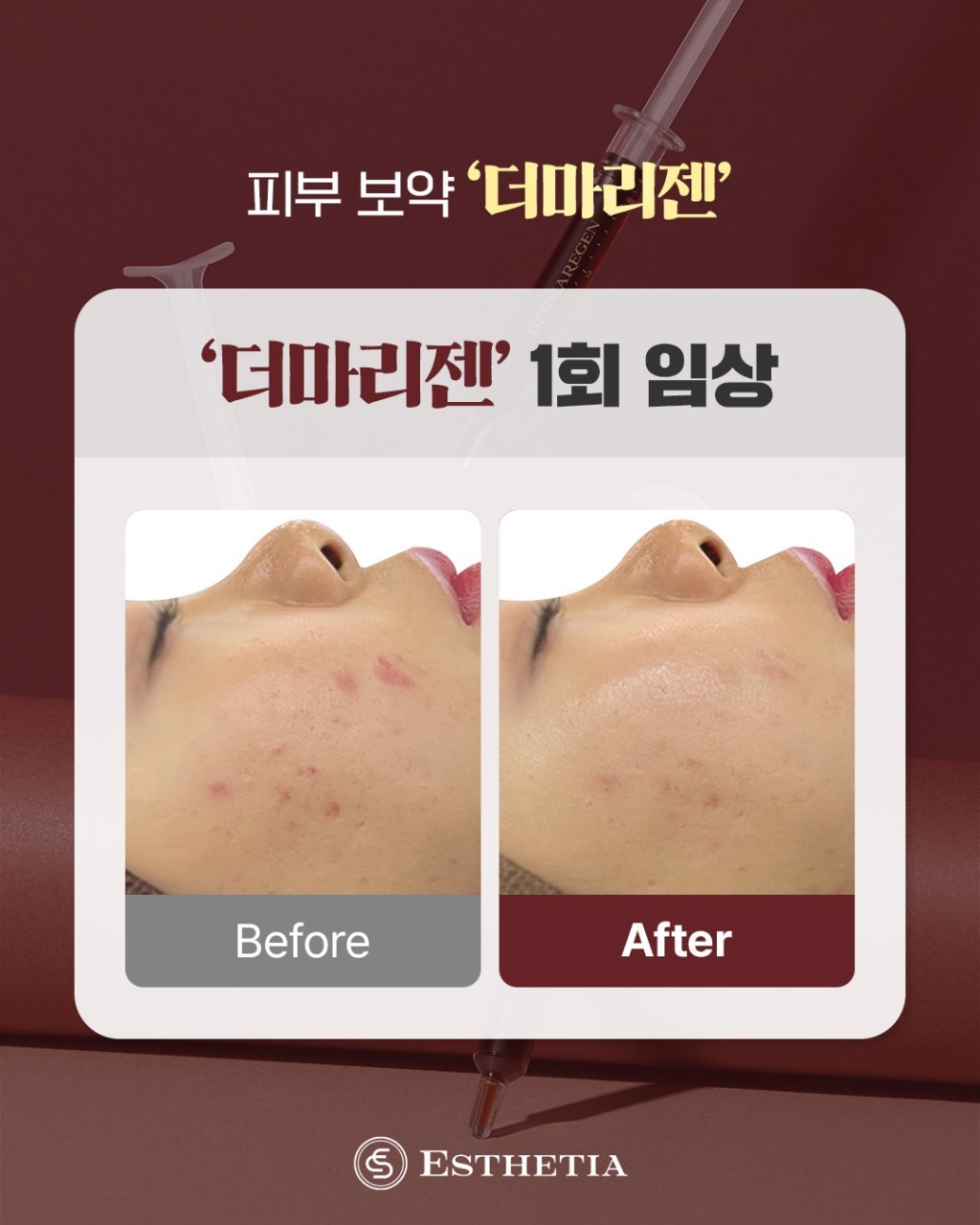 에스테티아 송파거여 1호점 photo 7