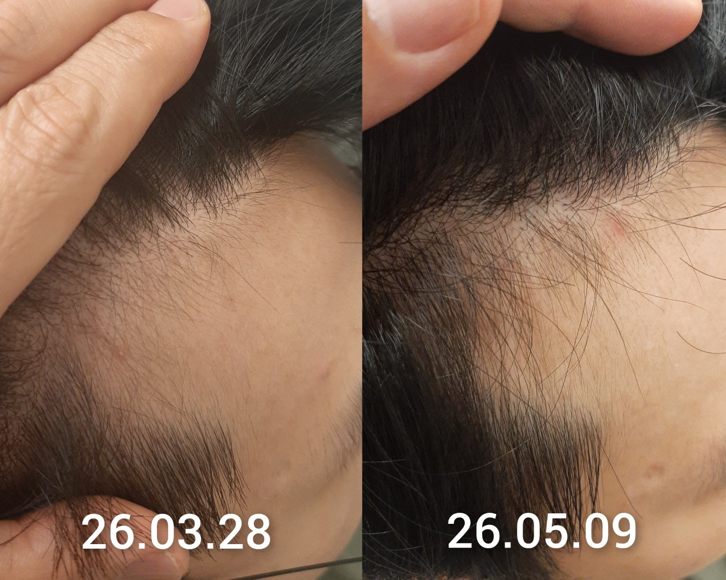 숲칼프 가산두피탈모전문센터 photo 5