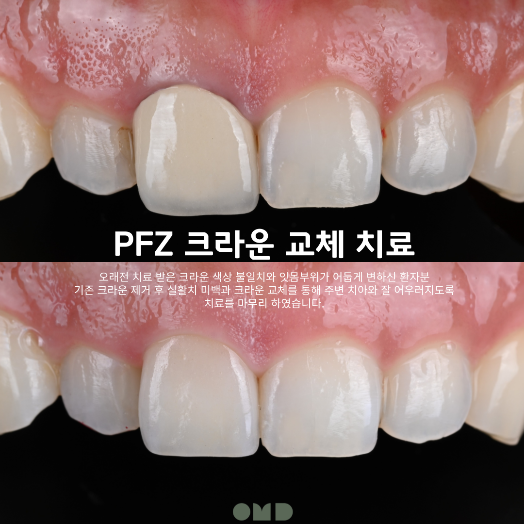 이보다치과의원 부천본원 대표 이미지