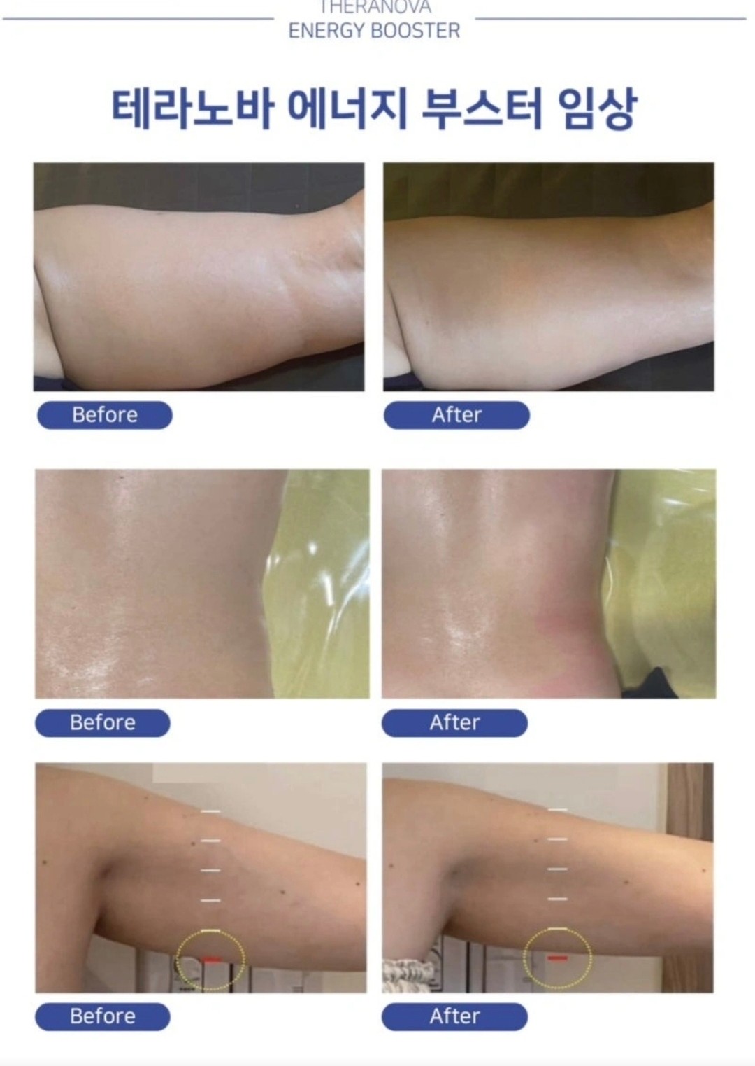 더 숲 테라피 해운대 장산 photo 5