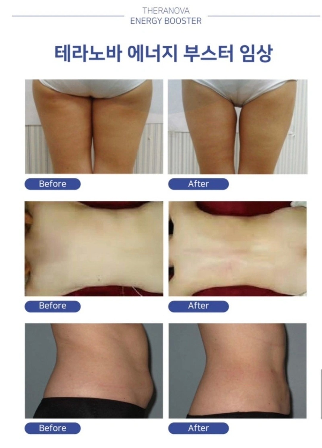 더 숲 테라피 해운대 장산 photo 4