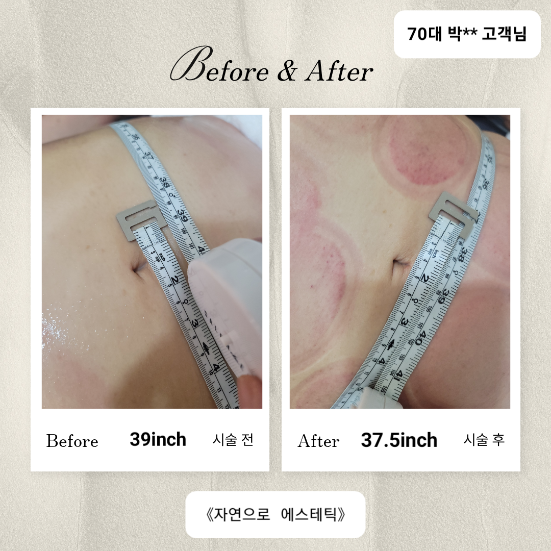 자연으로 photo 4