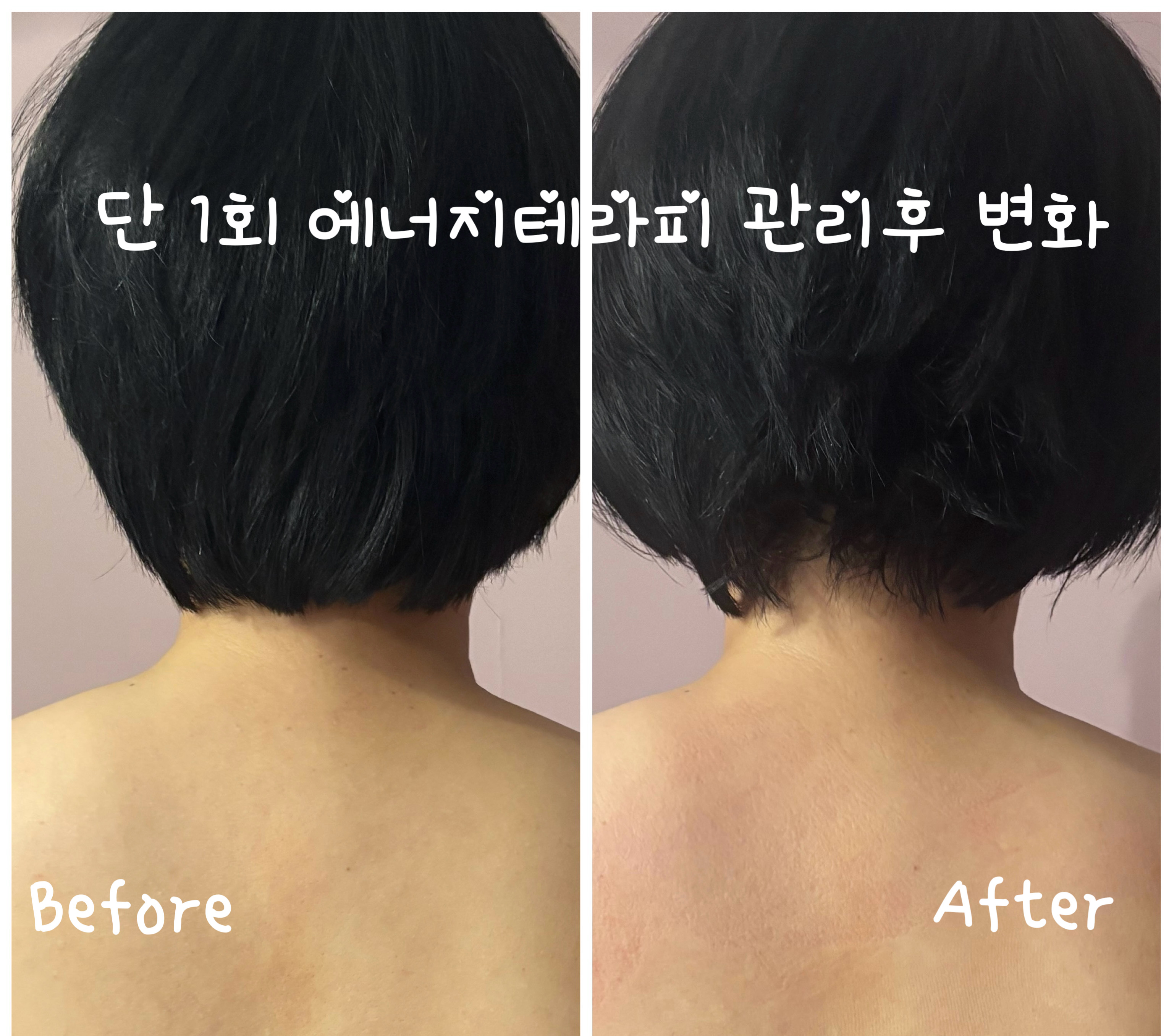 온하다에스테틱 첨단점 photo 9