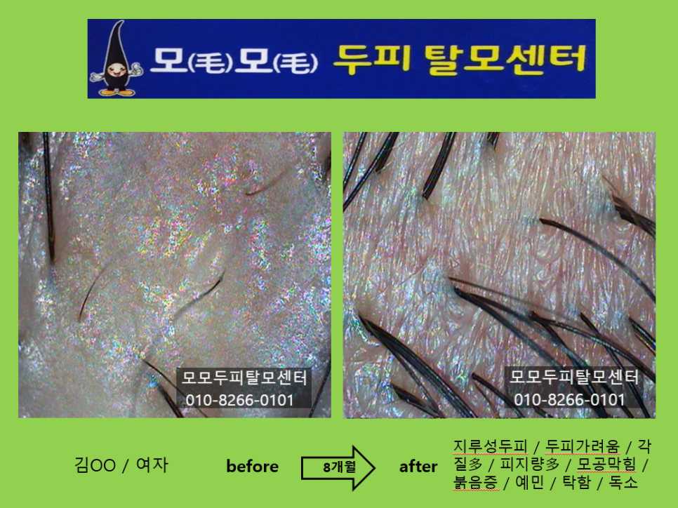 모모두피탈모센터 photo 3