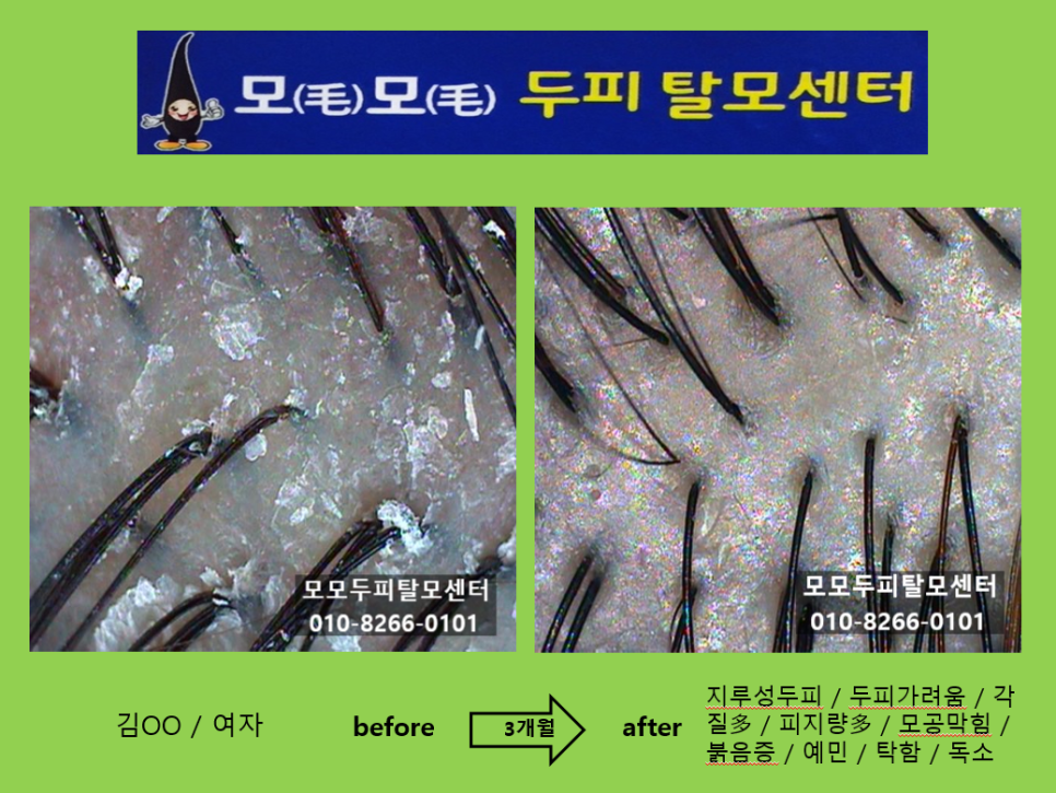 모모두피탈모센터 photo 10