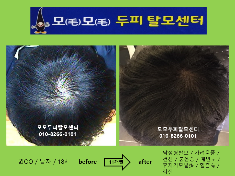 모모두피탈모센터 photo 7