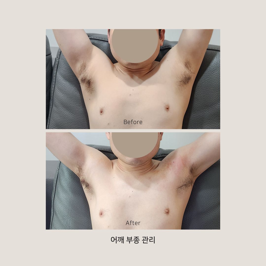 유연테라피 photo 5