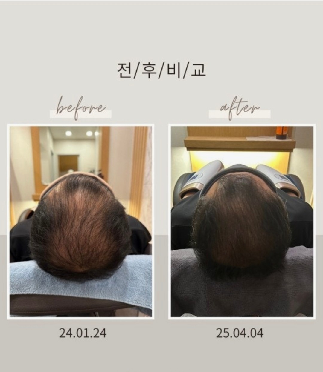 탑스칼프 원주점 대표 이미지