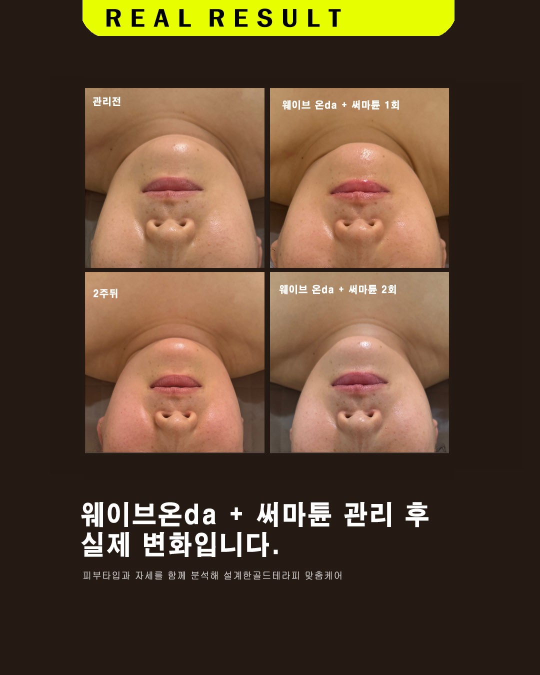 골드테라피마사지 김해장유점 photo 4