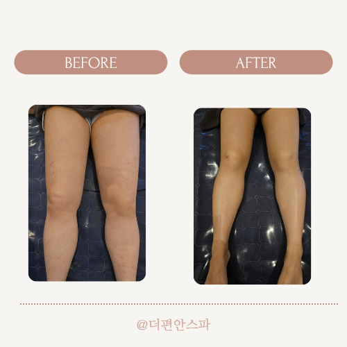 더편안스파 마사지 논현점 photo 7