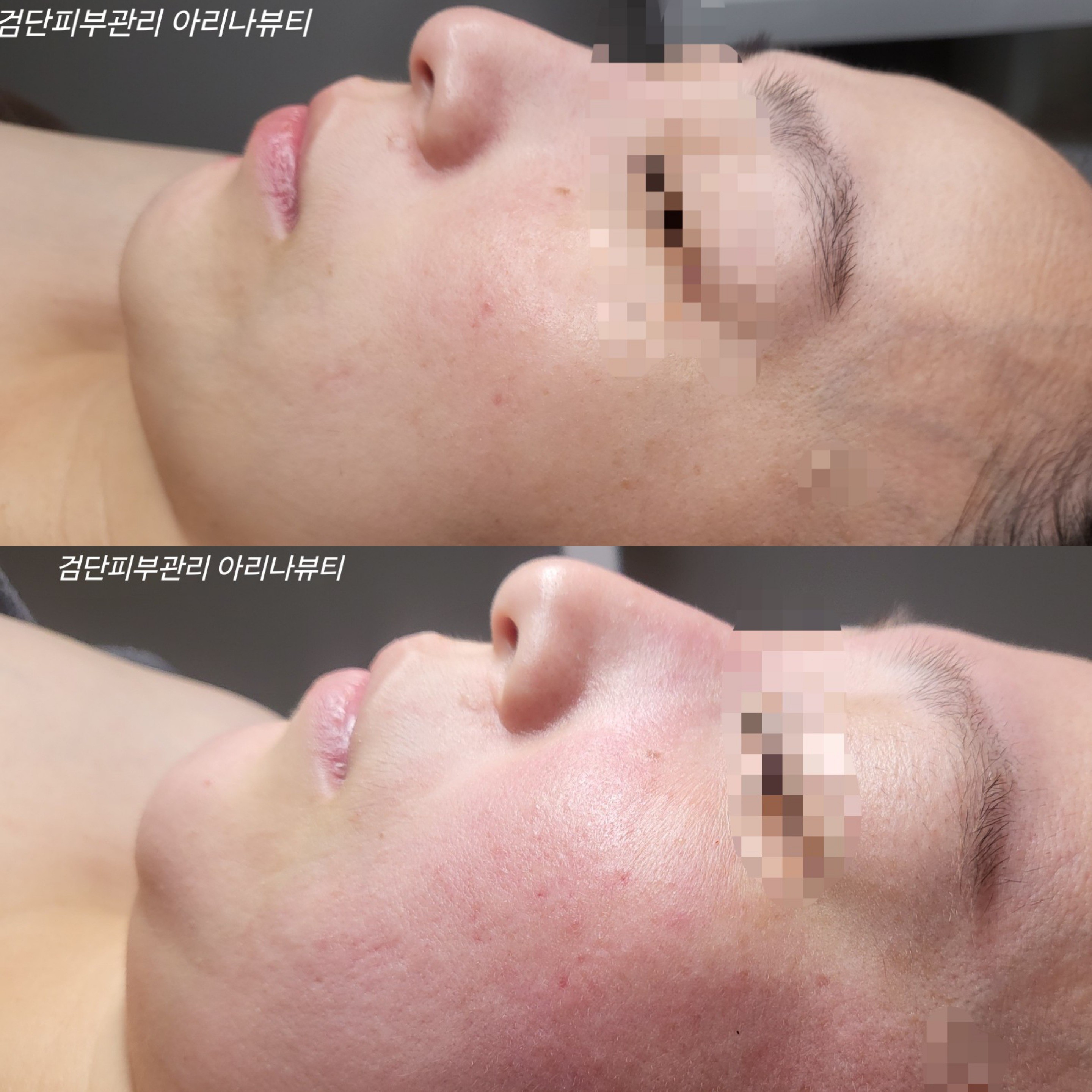 검단피부관리 아리나뷰티 photo 8