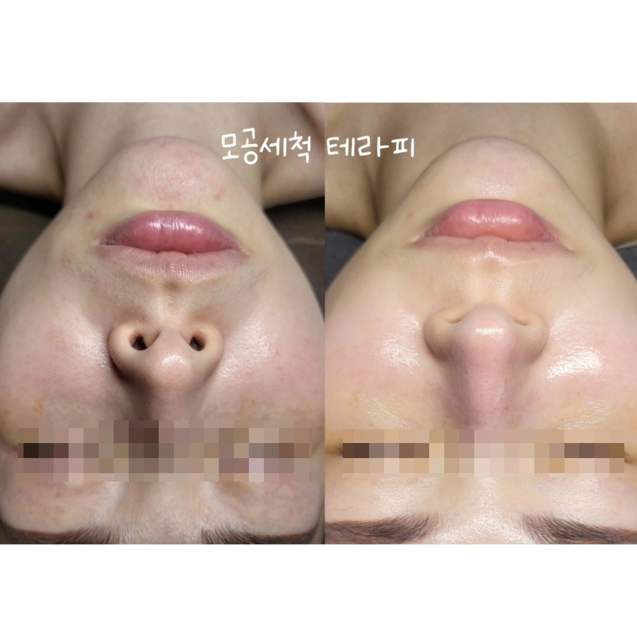 검단피부관리 아리나뷰티 photo 4