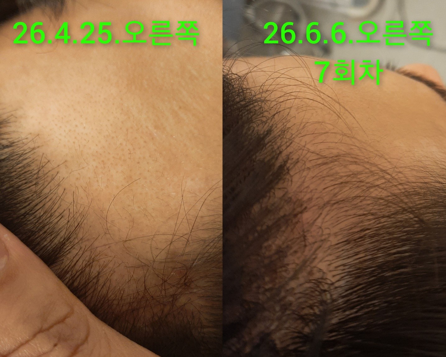 숲칼프 가산두피탈모전문센터 photo 7