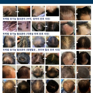 두피밥 평택점 photo 3