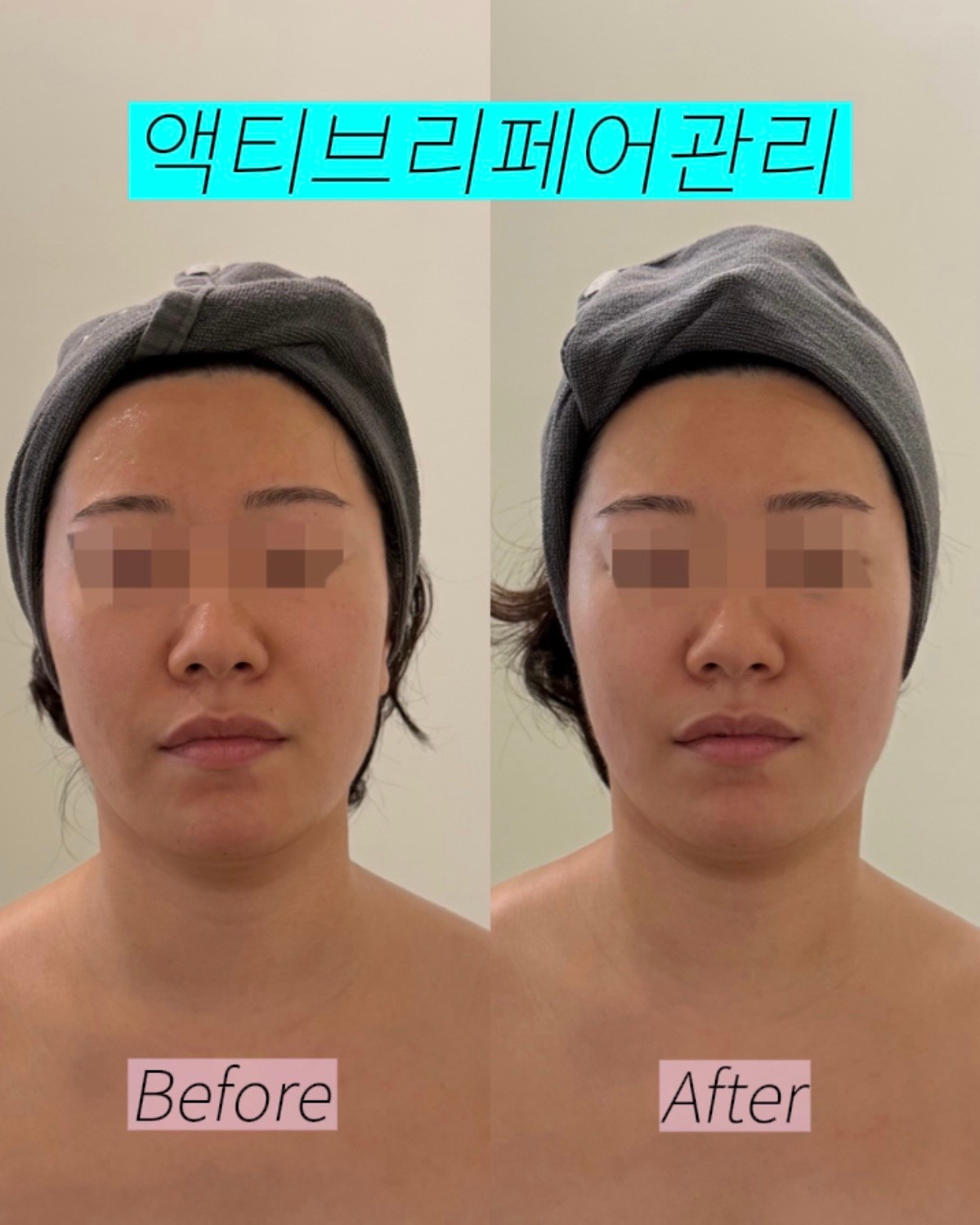 에스테티아 동남지구점 photo 2