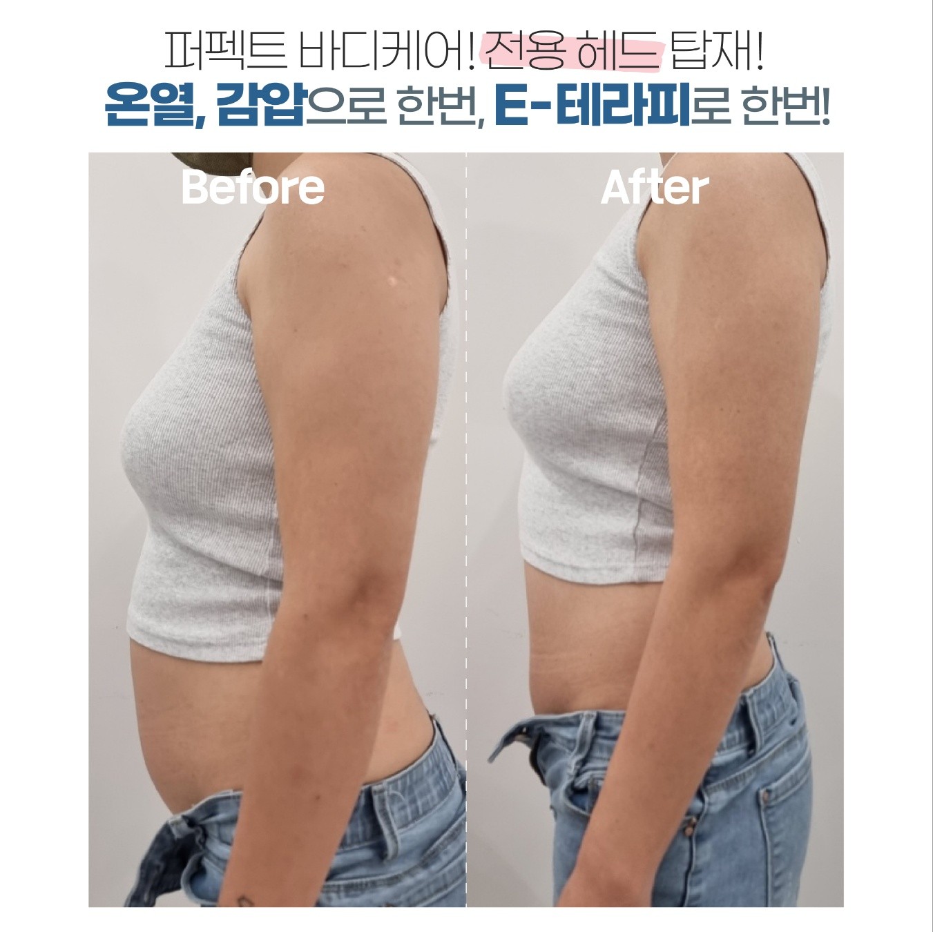 리본테라피 photo 5