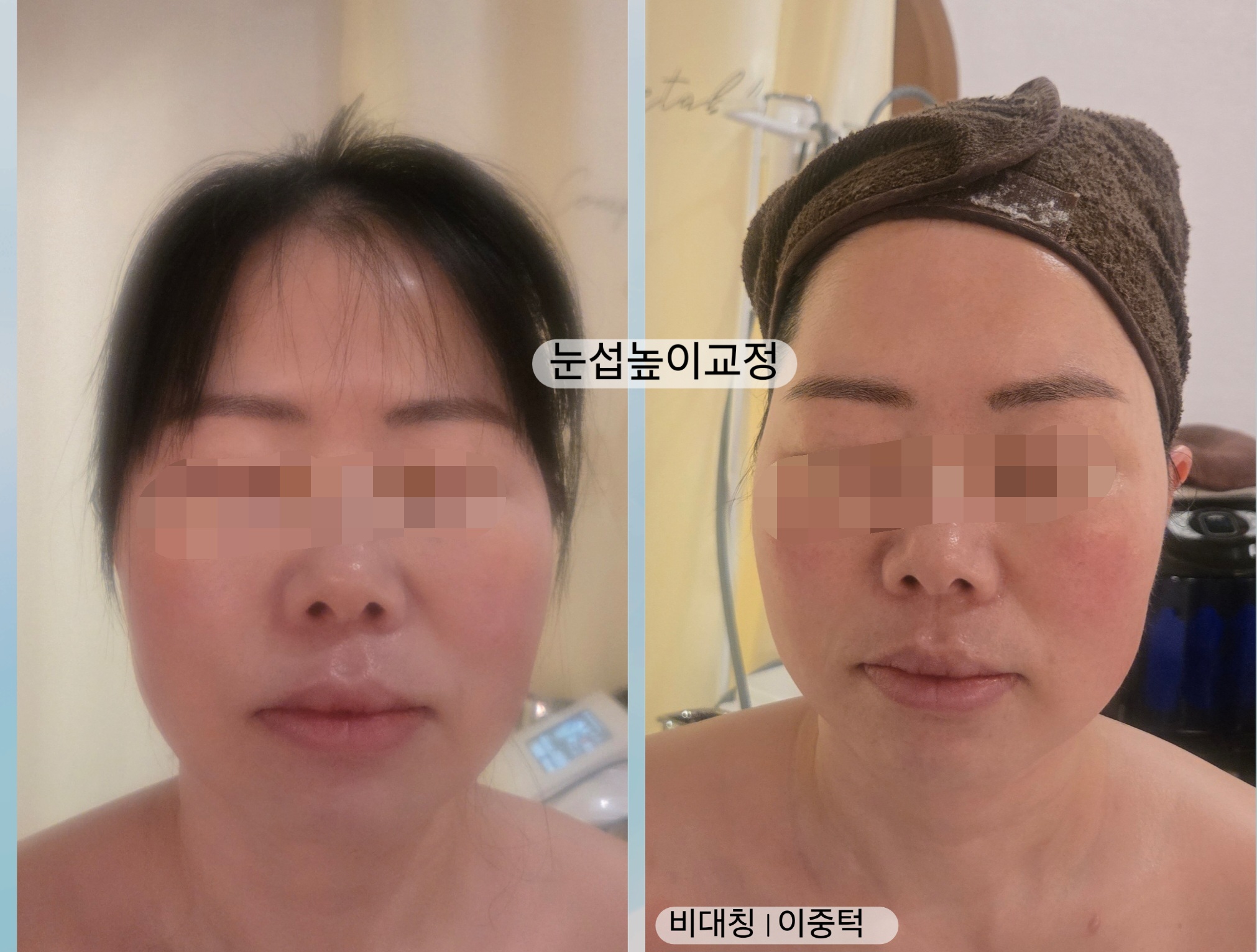 리본테라피 photo 2