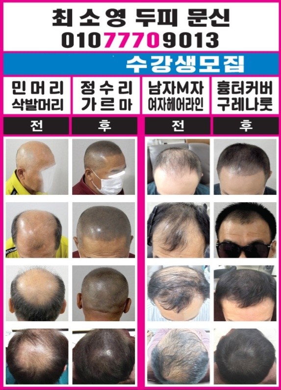최소영가발 대표 이미지