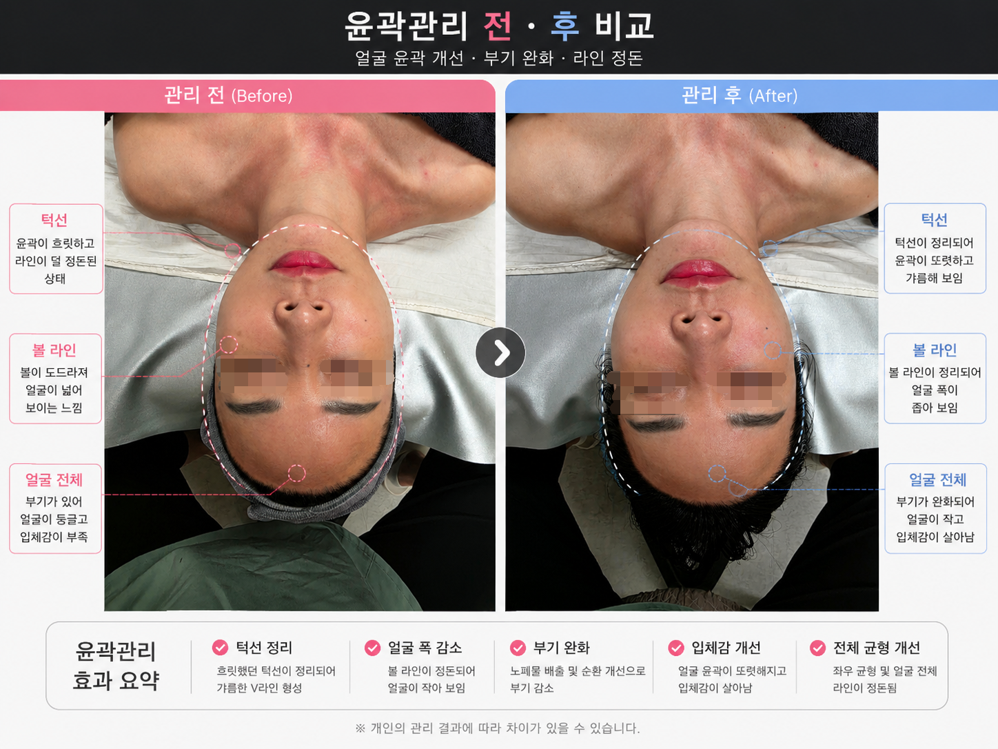 진심스킨케어